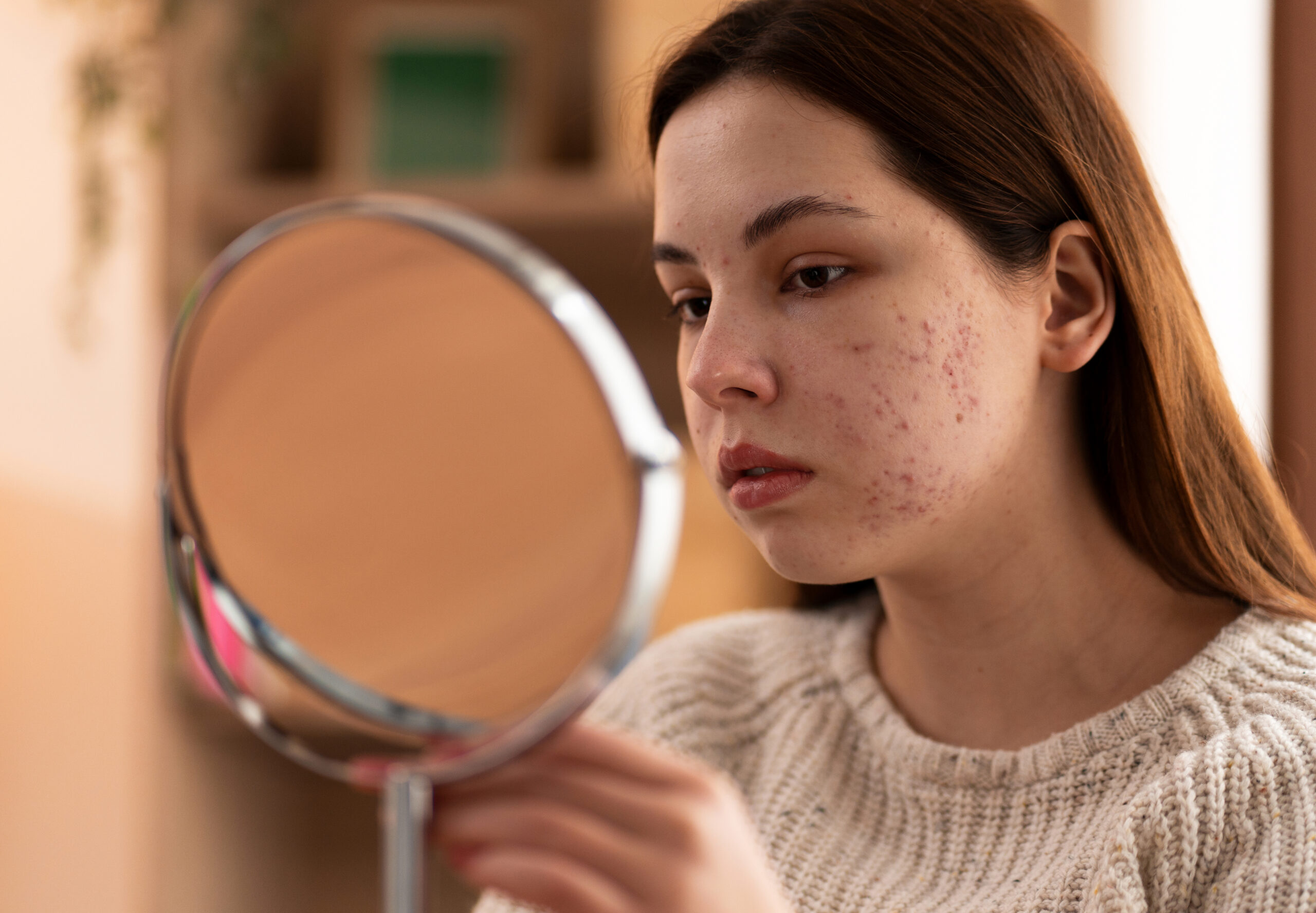 person-dealing-with-rosacea
