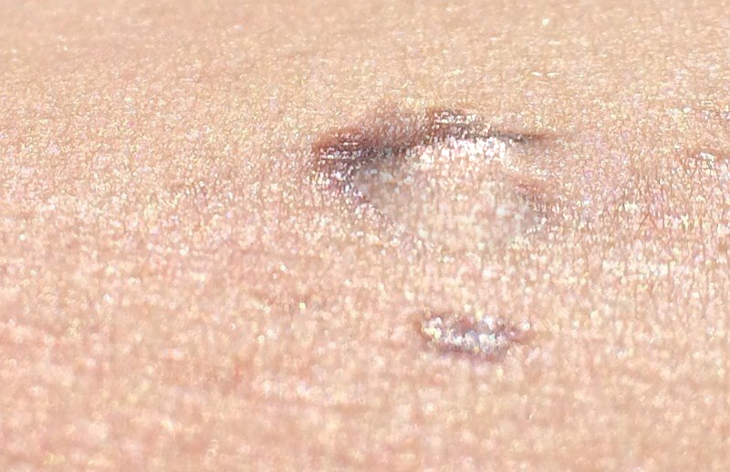 24619941432_c03c3048db_c-copy2