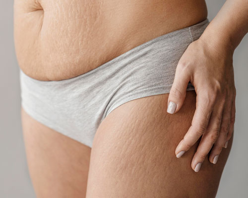 SR Derma Laser Clinic